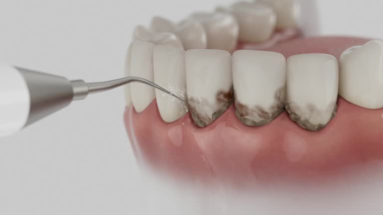Reliable Dental contractor in Pender, NE by Smile Center Dentistry